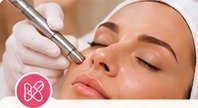 Microdermabrasión